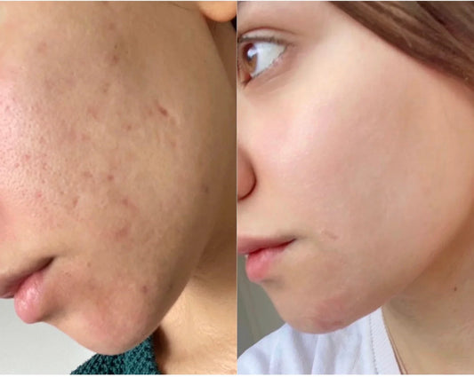Hair Skin & Nails Advice